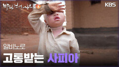 알비노로 고통받는 사피아 | KBS 250511 방송 
