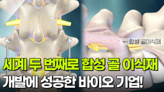 세계 두 번째로 합성 골 이식재 개발에 성공한 바이오 기업! | KBS 251207 방송 