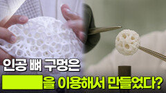 인공 뼈 구멍은 ███을 이용해서 만들었다?! | KBS 251207 방송 