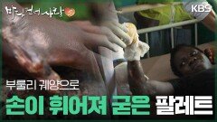 부룰리 궤양으로 손이 휘어져 굳은 팔레트 | KBS 251228 방송 