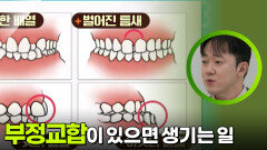 부정교합이 있으면 생기는 일들 | KBS 251123 방송 
