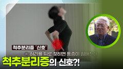 척추분리증의 신호?! | KBS 251130 방송 