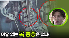 이유 없는 목 통증은 없다! ＂정기적인 건강검진 필수!＂ | KBS 251207 방송 