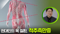 현대인의 목 질환, 척추측만증 ＂통증을 방치하면 생기는 문제는?＂ | KBS 251207 방송 