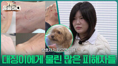 대징이에게 물린 많은 피해자들 | KBS 260309 방송 