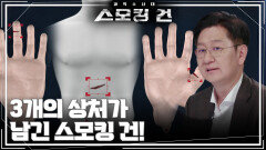 3개의 상처가 남긴 스모킹 건! | KBS 260324 방송 
