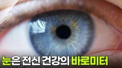눈은 전신 건강의 바로미터 | KBS 260714 방송 