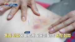 [엄마를 부탁해] 허리 통증으로 고통받는 백외자 씨 | KBS 250215 방송 