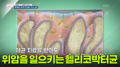 [집중탐구 내몸튼튼 플러스] 위암을 일으키는 헬리코박터균 | KBS 251226 방송 