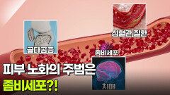 [굿모닝! 건강 브런치] 피부 노화의 주범은 좀비세포?! | KBS 260219 방송 