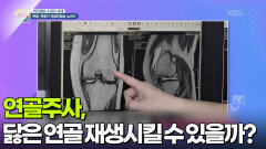 [퀴즈탐험 내 몸의 세계] 연골주사, 닳은 연골을 재생시킬 수 있을까? | KBS 260227 방송 