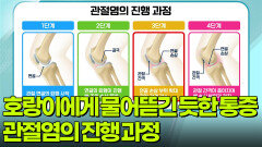 [퀴즈탐험 내 몸의 세계] 호랑이에게 물어뜯긴 듯한 통증, 관절염 | KBS 260227 방송 