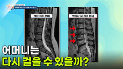[엄마를 부탁해] 어머니는 다시 걸을 수 있을까? | KBS 260416 방송 