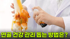 [사이언스LAB : 건강원] 연골 건강 관리 돕는 방법은? | KBS 260610 방송 