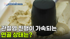 [사이언스LAB : 건강원] 관절염 진행이 가속되는 연골 상태는? | KBS 260610 방송 