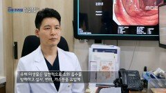 장 질환의 원인이 되는 유해 미생물!, MBC 220828 방송