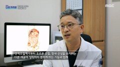 장내 세균들이 존재하면서 하는 역할!, MBC 220828 방송