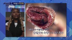 도마 위의 TV - ＜전국 1등＞, MBC 251025 방송