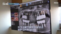 12개의 치아를 잃은 남자, MBC 251201 방송