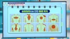 등·목·겨드랑이 뜻밖의 통증, MBC 260123 방송