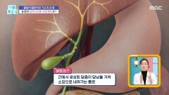 [기분 좋은 날] 너무나 생소한 담도암, 발생 위치는?, MBC 260220 방송