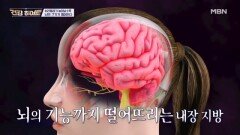 뱃살이 많은 당신의 뇌 상태 MBN 260423 방송