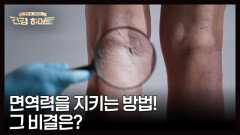 붓는 게 면역력 저하의 신호다? MBN 260129 방송