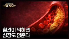 돌연사까지 부르는 조용한 시한폭탄 콜레스테롤 MBN 260430 방송