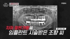 임플란트 11개 한 50대 주부의 사연… 엄마에게서 딸에게로 대물림된 골다공증 MBN 260610 방송