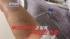 무너진 면역력을 다시 세워라 MBN 260304 방송