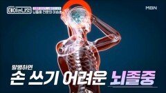 사상 최악의 두통, 사망률 50%?! 이승훈 교수가 설명하는 뇌졸중 MBN 260307 방송