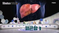 간 건강이 무너지면 만성 피로에 시달린다 MBN 251207 방송