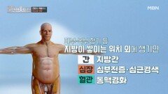 응급상황을 부르는 이소성 지방 MBN 260222 방송
