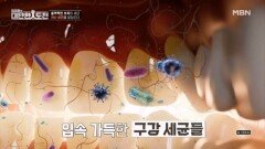 입속 관리 잘못하면 세균과 치석을 만들 수 있다 MBN 260308 방송