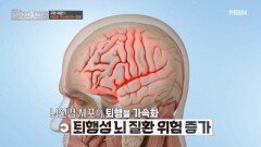 치아 속 세균 덩어리가 뇌졸중·심근경색 위험을 키운다 MBN 260308 방송