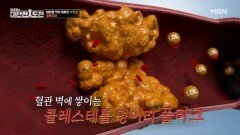 포화지방과 탄수화물이 혈관의 플라크를 만든다 MBN 260531 방송