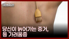 등이 간지럽다면 피부 노화가 시작되었다는 뜻! MBN 260208 방송