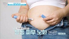 다이어터 사이에서 핫이슈인 위고○를 맞은 사람을 구별할 수 있다?! MBN 260110 방송