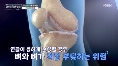 극심한 통증을 부르는 연골의 손상과 관절염의 위험 MBN 260222 방송