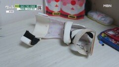 아킬레스건 수술을 한 둘째 딸 MBN 260131 방송