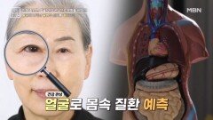 얼굴에 나타난 질병의 신호를 캐치하라 MBN 260116 방송