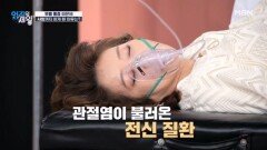 (엄지 극장) 무릎 통증 때문에 사망까지 하게 된 이유는?? MBN 251111 방송
