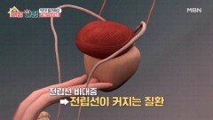 남자들만 아는 고통 전립선 비대증, 그것이 궁금하다! MBN 251211 방송