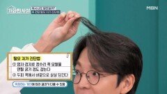 혹시 나도 탈모?? 초 간단 탈모 자가 진단법 ＜모발 당김 검사＞ MBN 260303 방송