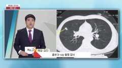 투데이 주치의 - 폐암 검진 (한국건강관리협회 부산센터 / 김경민 과장)