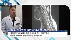 [건강365] 무거운 목? ′경추 디스크 내장증′