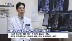 [건강365] 폐경기 허리 방사통, ′척추 미끄럼증′