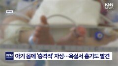 “이혼할 남편에 뺏길 수 없다” 신생아 딸 살해한 엄마 ‘경악’/ KNN