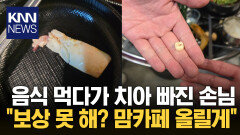 음식 먹다 치아가 ′쏙′...손님 ＂보험처리 해줘!＂ 버럭 / KNN