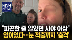 시력 저하 증상 심해져 찾은 병원 알고 보니 4.5cm의 종양…′충격′ / KNN